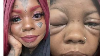 Woman goes blind after following an influencer to tattoo her eyeballs