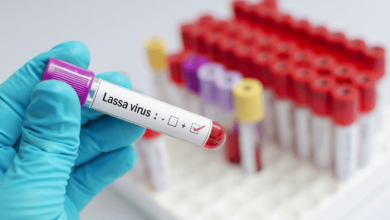 12 new Lassa Fever cases confirmed in Ghana