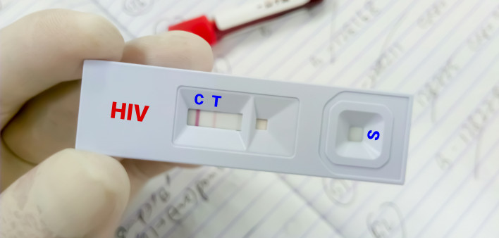 HIV self-testing kit receives high patronage in less than a month