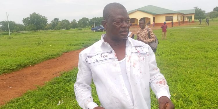 North East region: Alan’s campaign coordinator attacked