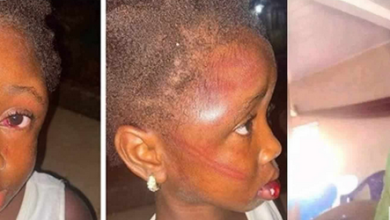 5-yr-old girl mercilessly beaten by her aunt for taking food from pot to eat