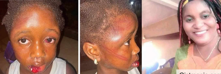 5-yr-old girl mercilessly beaten by her aunt for taking food from pot to eat